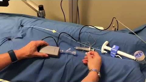 self expanding stent