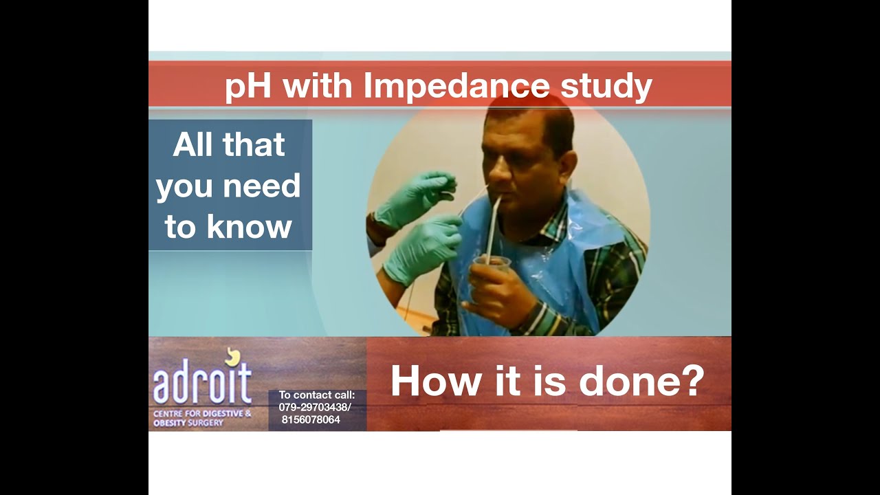 hernia icd 10 pH Study or pH with Impedance study: How is it done?