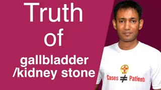 Gallbladder ,kidney Stone का घरेलू  रामबाण उपाय|| By Dr Biswaroop Roy Chawdhury