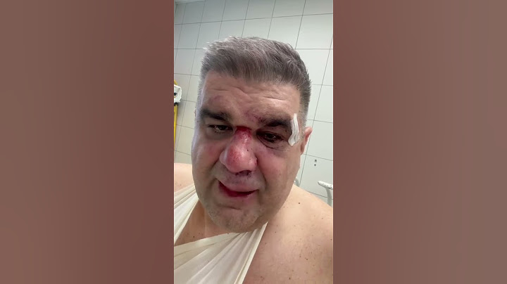 Oglasio se Saša Mirković "OVO JE BIO POKUŠAJ UB!STVA  #sasamirkovic