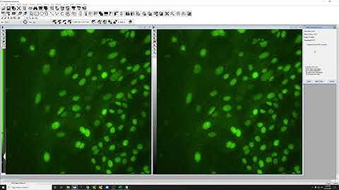 26 Metamorph - Multiple positions - Spinning disk Hagrid