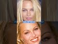 Has Pamela Anderson Had Plastic Surgery?