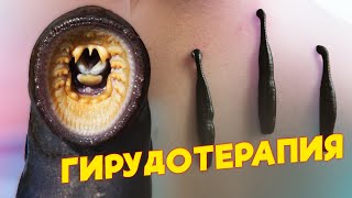 Паразиты, которые могут вас вылечить!?