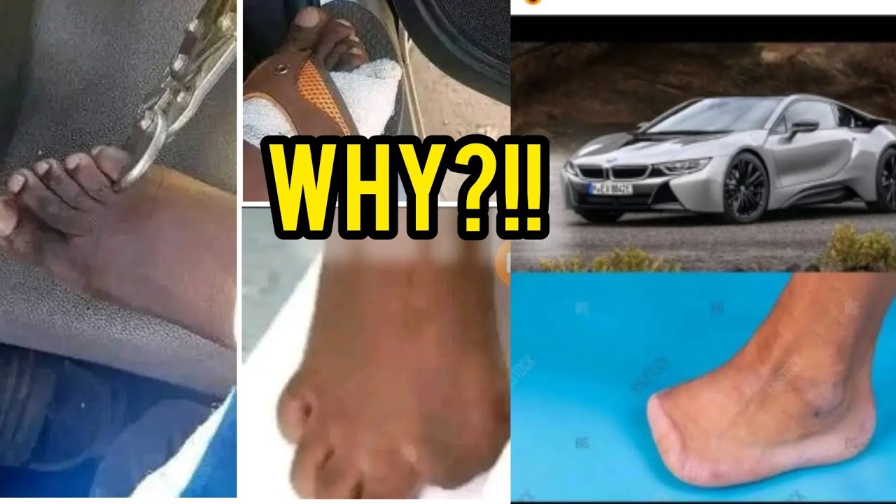 TOES FOR SALE IN ZIMBABWE. HOW REAL IS IT?(selling toes for money