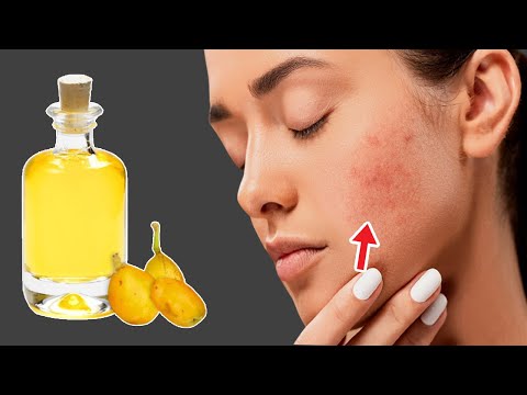 Top 7 Hidden Marula Oil Benefits || Marula Oil for Acne Scars