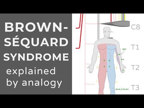 Brown Sequard Syndrome | Animation | Explained Conceptually