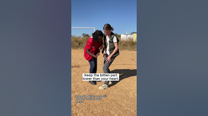 Myths About Treating Snake Bites #FirstAid #LearnOnYouTube