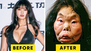 10 Times Plastic Surgery Went Horribly Wrong