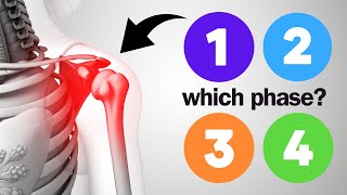 How To Clearly Tell Where You Are In the 4 Phases Of Healing For A Rotator Cuff Tear