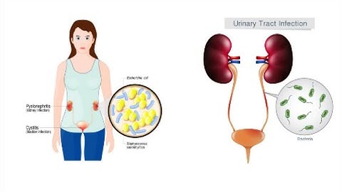 Staphylococcus saprophyticus |microbiology
