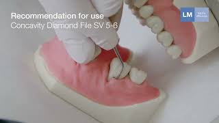 How to use LM™ Concavity Diamond File SV 5-6 hand instrument