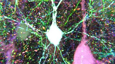 Pyramidal neurons