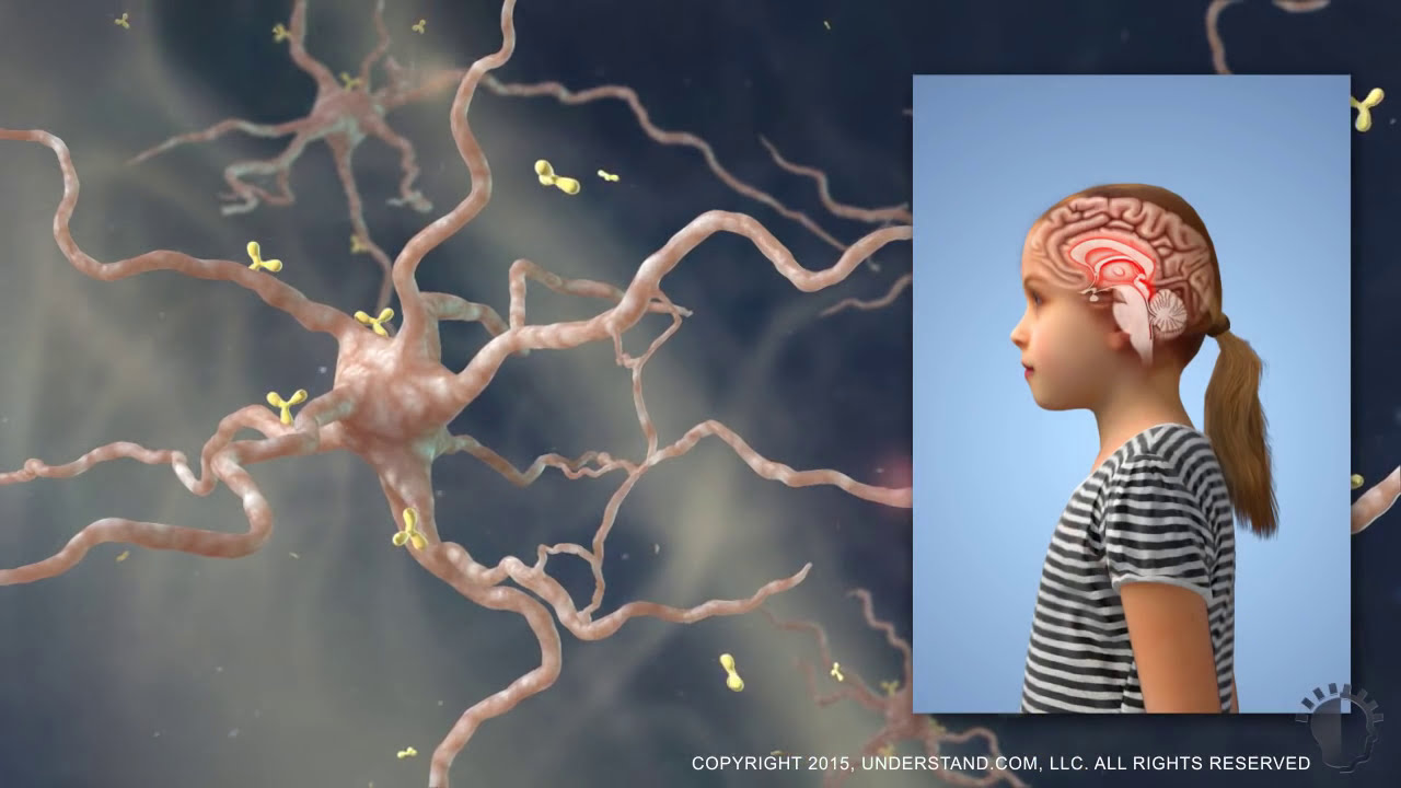 Moleculera Labs Patient Stories Watch 20 20 And Nightline Full Episodes On Pandas