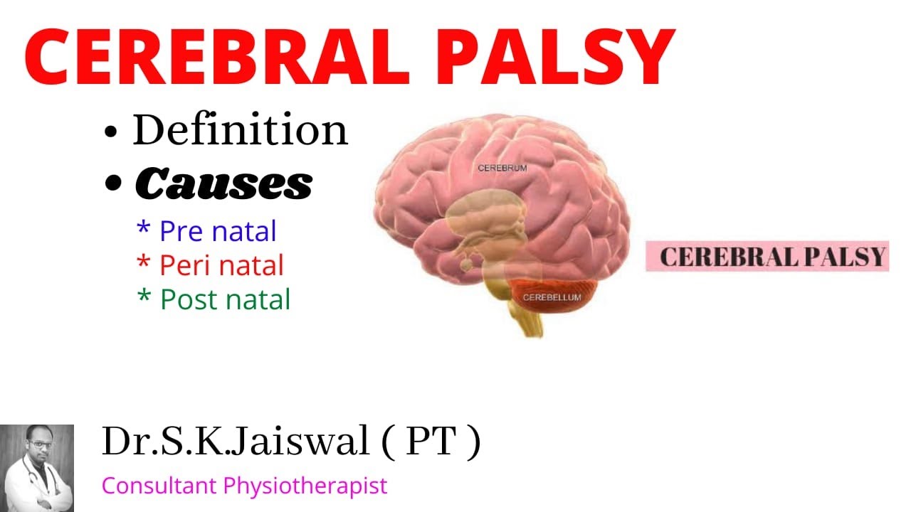 Cerebral Palsy Definition & Causes YouTube