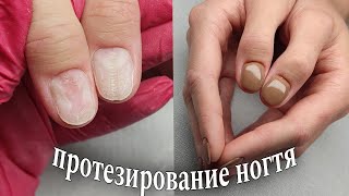 Протезирование ногтя 👌🏻😉#маникюр #красивыйманикюр #ногти