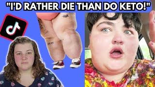 Celebrity Fat activist would rather die than get treatment | Fat acceptance cringe | Jordan Underwood Lump Leg Profile
