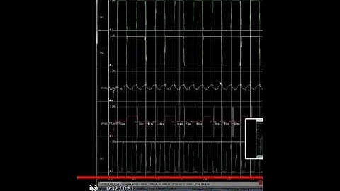Low Power 4×4 Bit Multiplier Design using Dadda algorithm and optimized full adder VLSI XILINK