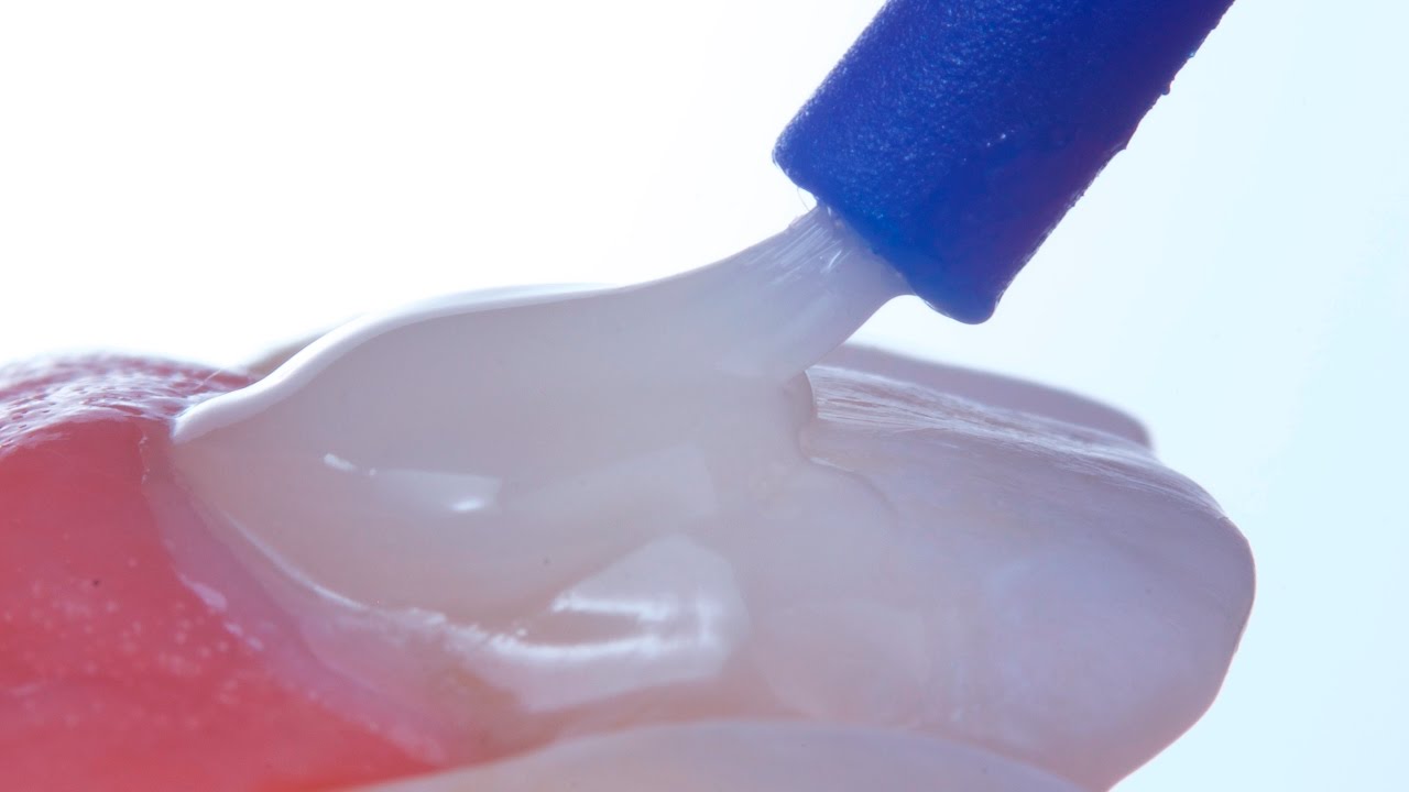 Protocolo Clínico associativo para tratamento de hipersensibilidade dentinária