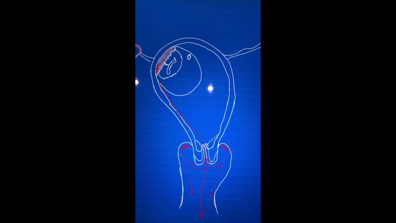 أعراض الإجهاض... لاسمح الله إذا راح تمريّ بإجهاض .. إيش الأعراض المتوقعة وليش بتصير...