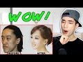 Korean Plastic Surgery Before and After Photos Reaction