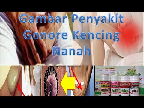 gambar-penyakit-gonore-kencing-nanah