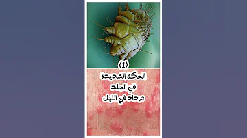 اعراض مرض الجرب عند الانسان احذر من الجرب فى الشتاء اعرف علاماته وسارع بالكشف 