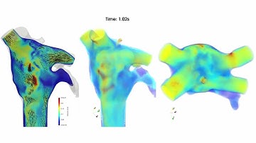 Interview of Oscar Camara, UPF,  explaining simulation of blood flow and LAAO in SimCardiotest