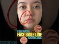 Ramove Face Smile Line Exercise