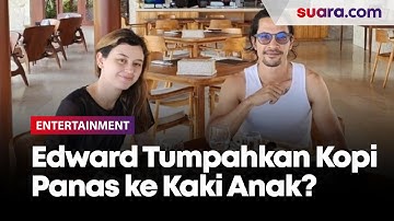 Lebih Parah dari Kimberly Ryder, Edward Akbar Disebut Pernah Tumpahkan Kopi Panas ke Kaki Anak