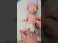 Surgery Time for Preemie Silicone Baby