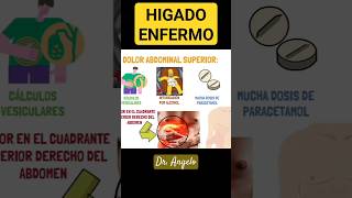 SINTOMA que Indica DAÑO en el HIGADO #doctor #consejos #ciencia #salud #dr