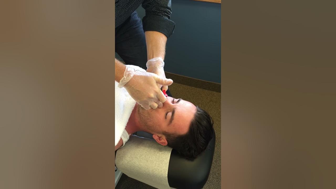 Nasal Specific Treatment Procedure Chiropractic Adjustment YouTube nasal-specific-treatment-procedure-chiropractic-adjustment-youtube