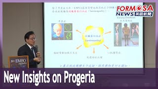 Headway into solving mystery of ‘premature aging disorder’