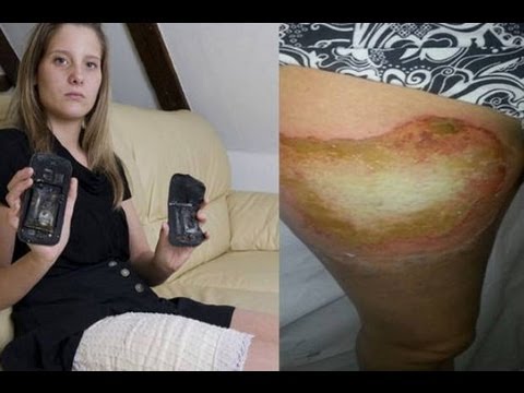  UNA MUJER CASI AMPUTANDOCELA POR EL CIDO DE LA BATERA  YouTube