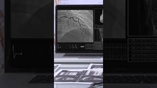 Blood Clots Dissolved Naturally