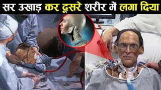 सर उखाड़ कर दूसरे शरीर में लगा दिया head transplant ! Earth Adventure in Hindi