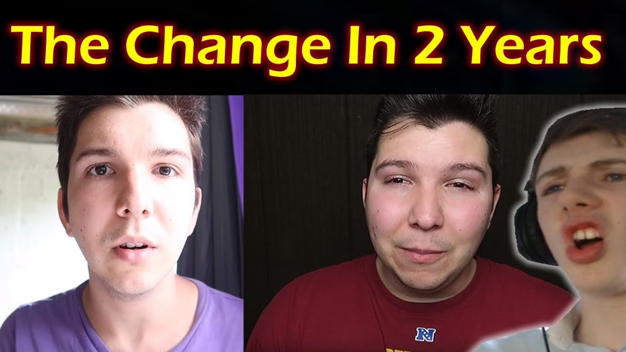 After before and niko avocado