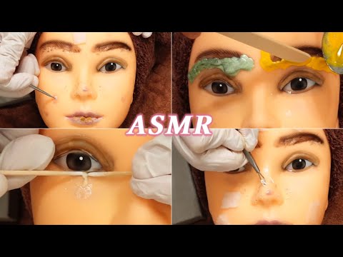 【ASMR】ニキビ押し出し／眉毛ワックス脱毛／眼球掃除で急な肌荒れに集中ケア✨睡眠誘導