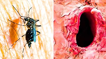 10 Things You Can Only See Under Microscope