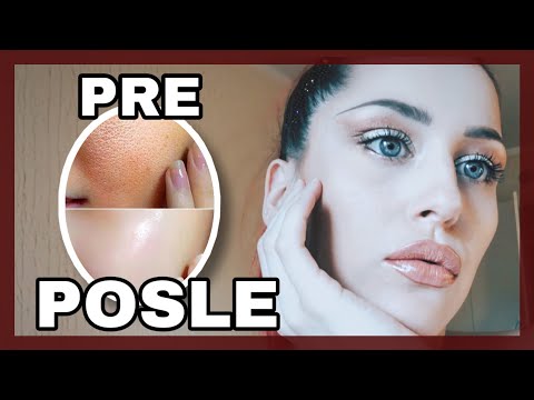 10 STVARI KOJE STE DO SADA RADILI POGRESNO KADA JE NEGA KOZE U PITANJU | Kiki fabulous