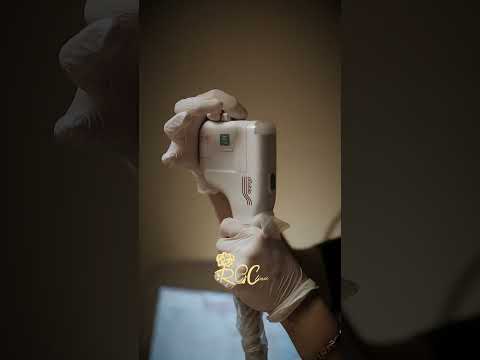 Laser Skin Treatment