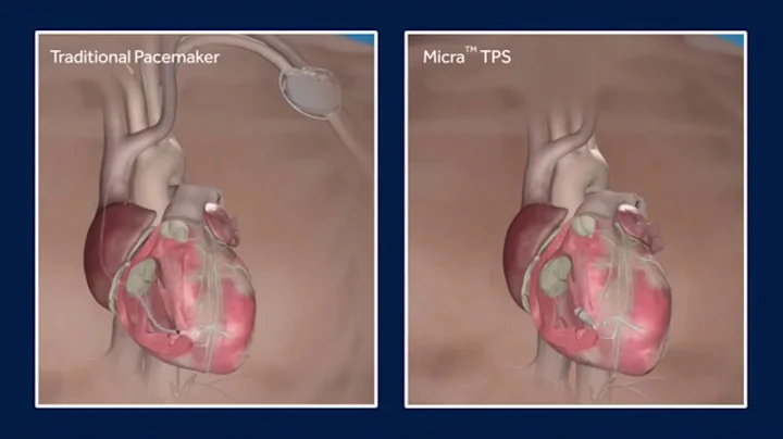 Magic of Materials Project