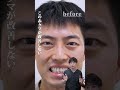 クマ取り▶30代男性(疲れ顔を撃退)