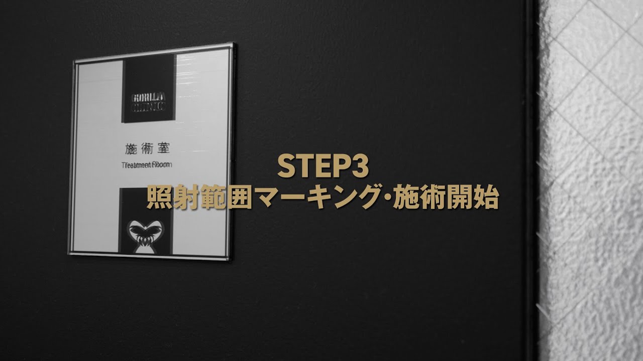 STEP3 照射範囲マーキング・施術開始【ゴリラクリニック脱毛施術の流れ】