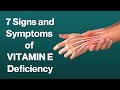 7 signs and symptoms of vitamin e deficiency  visitjoy