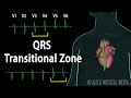 Understanding ECG/EKG: QRS Transitional Zone and R Wave Progression Explained, Animation