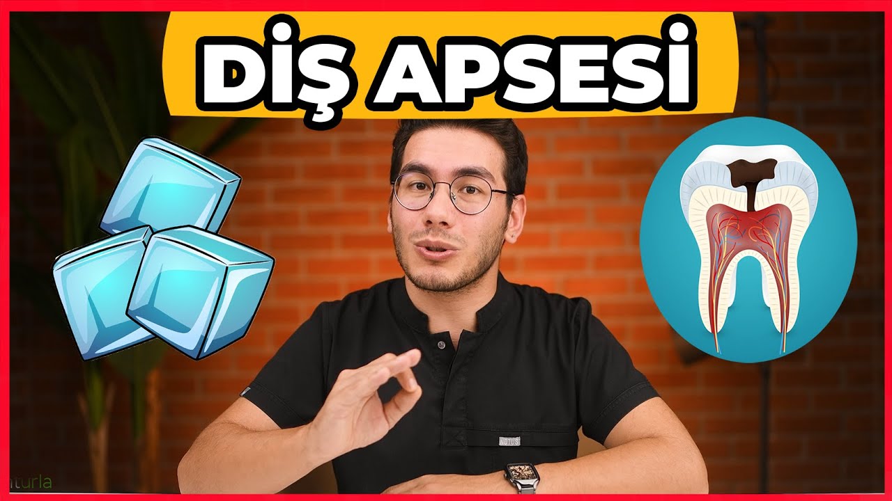 Diş Apsesi Nasıl Geçer... EVDE YAPILACAKLAR ! - Uzm. Dt. Mert Ertekin