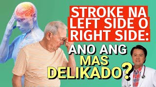 Stroke na Left side or Right side: Ano Mas Delikado?   By Doc Willie Ong Internist and Cardiologist