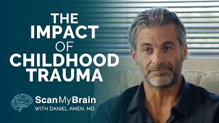 The Impact of Childhood Trauma on The Brain with Jim Curtis