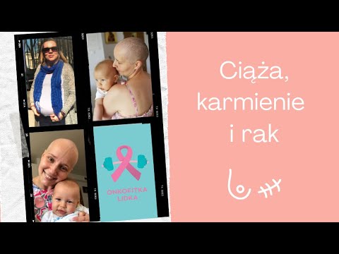 Wideo: Rak Piersi Podczas Ciąży: Leczenie, Zagrożenia I Karmienie Piersią